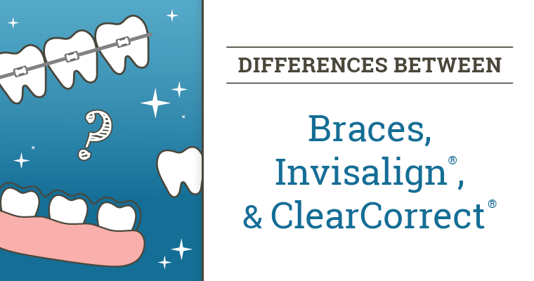 The Different Between Braces, Invisalign®, & ClearCorrect®